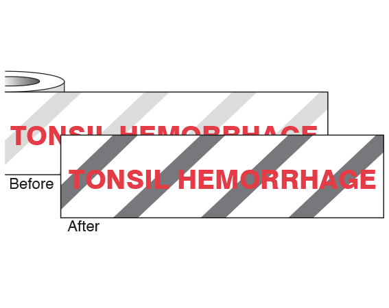 CS-274 Imprinted Identification Tape for Steam Autoclaves